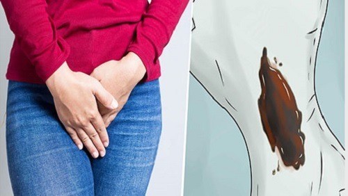Khí hư màu nâu là dấu hiệu bệnh gì? 5+ Cách hỗ trợ điều trị hiệu quả