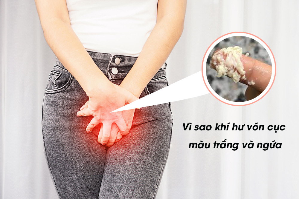 Vùng kín bị ngứa và có dịch trắng vón cục : Nguyên nhân + Cách hỗ trợ chữa trị
