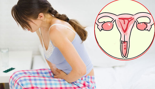Ung thư cổ tử cung có nguy hiểm không? Cách phòng ngừa hiệu quả