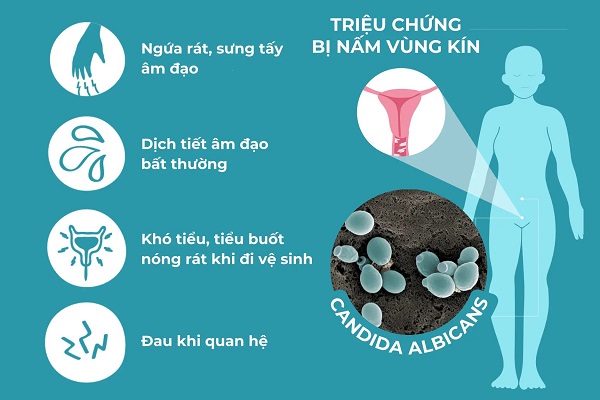 Phát hiện dấu hiệu bị nấm vùng kín phải làm gì?