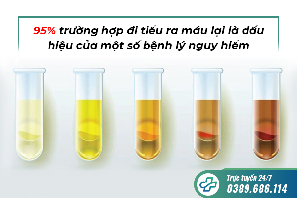 Tiểu buốt tiểu rắt ra máu ở nữ giới – Đừng chủ quan!