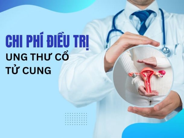 [Chi tiết] Chi phí điều trị ung thư cổ tử cung