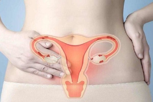 [Cảnh báo] 6+ Nguyên nhân ung thư cổ tử cung chị em cần lưu ý