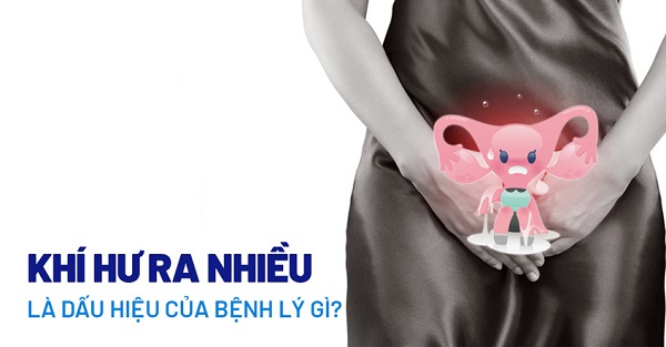 Khí hư ra nhiều là bị gì? Cách hỗ trợ điều trị hiệu quả
