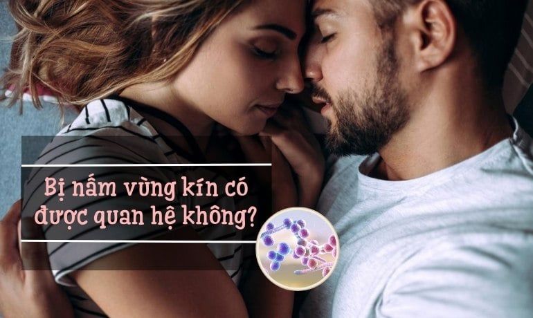 Bị nấm vùng kín có được quan hệ không? Cần lưu ý gì?