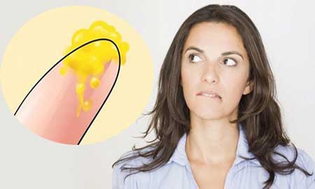 Khí hư màu vàng và ngứa – Cảnh báo 5 bệnh phụ khoa nguy hiểm