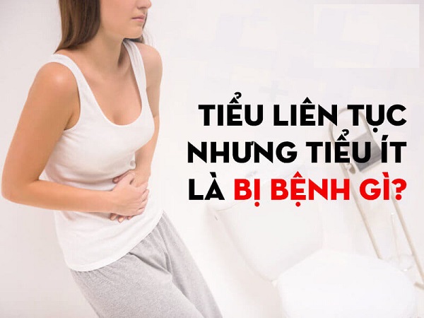 Mắc tiểu liên tục nhưng tiểu ít ở nữ: Nguyên nhân, cách chữa trị hiệu quả